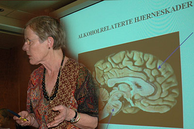 Kari Skullerud